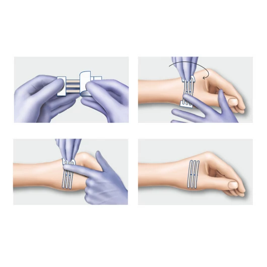 Omnistrip® sebzáró csík (6x76 mm; 3 csík x 2 lap)