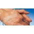 Kép 4/4 - DermaPlast® Water Resistant sebtapasz (40 db)